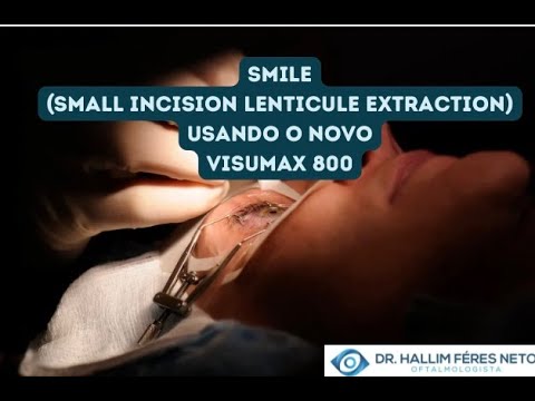 SMILE usando o novo Visumax 800