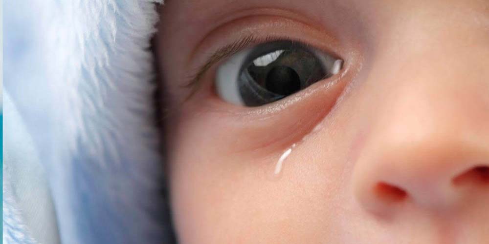 Dr Hallim Obstrução Congênita do canal lacrimal do bebe