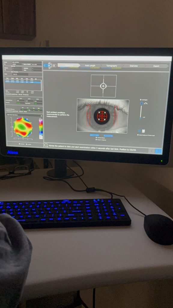 Sightmap medindo um olho antes da cirurgia refrativa com Ray Tracing