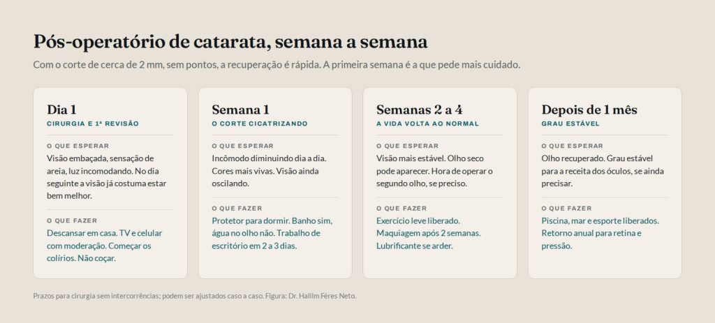 Pós-operatório de catarata semana a semana: o que esperar e o que fazer no primeiro dia, na primeira semana, da segunda à quarta semana e depois de um mês