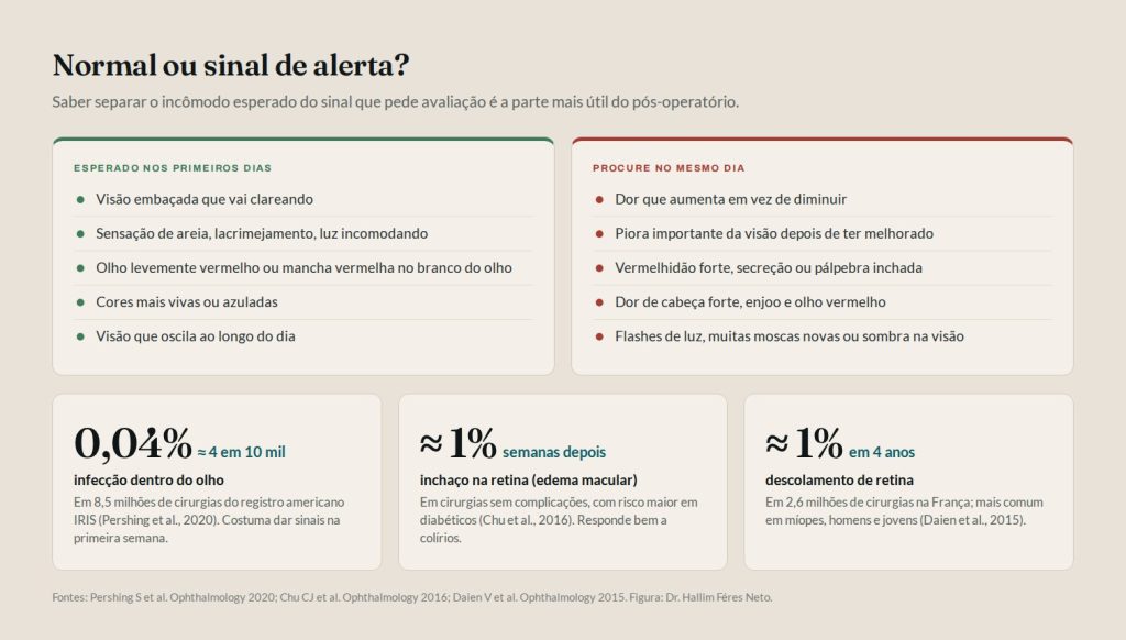 Pós-operatório de catarata: sintomas esperados nos primeiros dias e sinais de alerta que pedem avaliação no mesmo dia