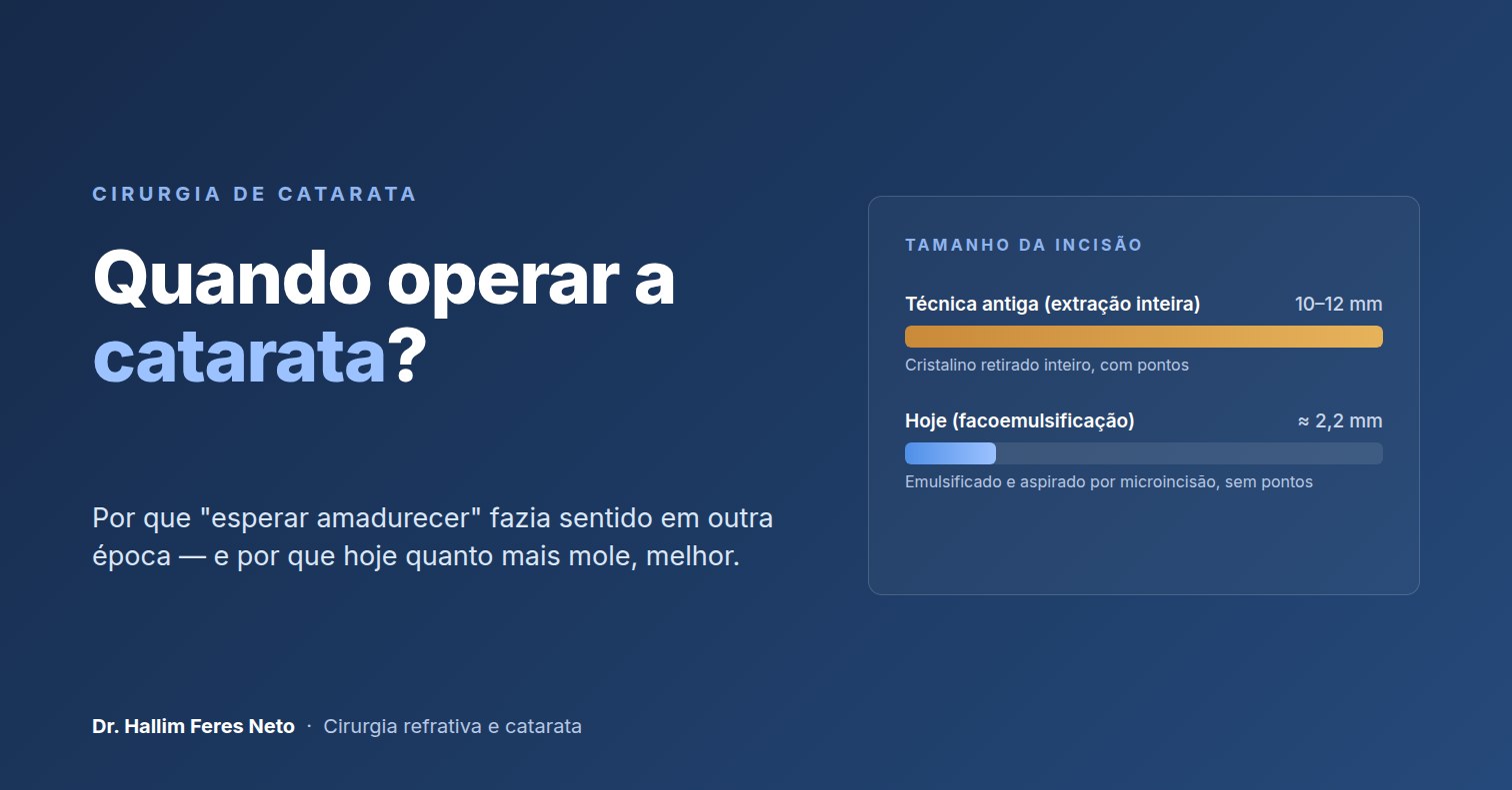 Quando operar a catarata? Por que não é preciso esperar amadurecer — Dr. Hallim Feres Neto